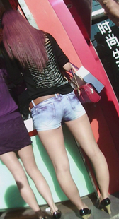 少妇大腿严重变形