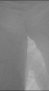 透视一下穿什么内内